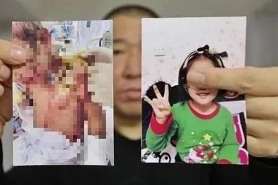 Vụ bé gái 6 tuổi bị mẹ ruột và nhân tình bạo hành: Lời kể của bố ruột gây đau lòng, luật sư khẳng định 