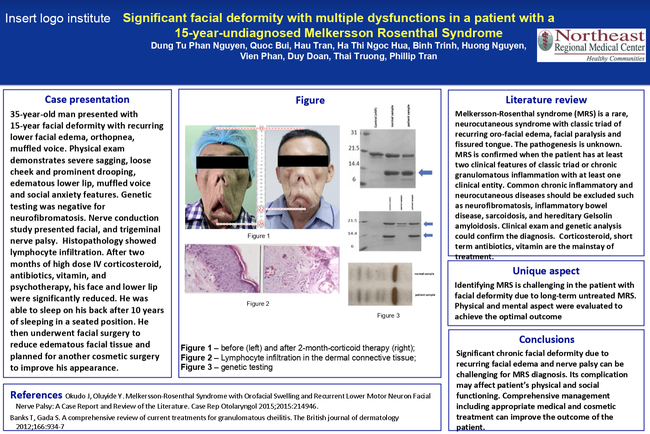 Căn bệnh của người đàn ông mặt quỷ đã được giải mã, giành giải thưởng tại cuộc thi y khoa ở Hoa Kỳ-1