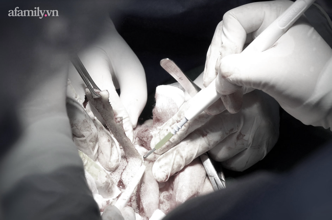 Căn bệnh của người đàn ông mặt quỷ đã được giải mã, giành giải thưởng tại cuộc thi y khoa ở Hoa Kỳ-4