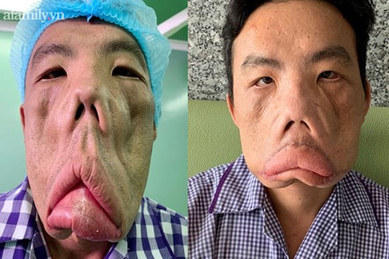 Căn bệnh của người đàn ông