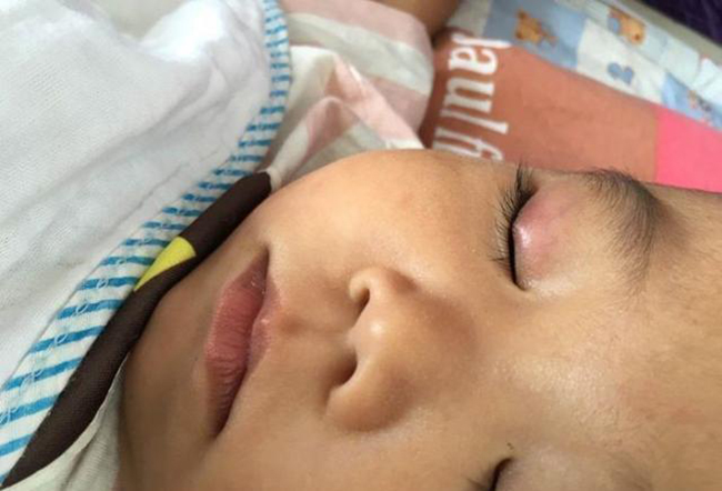 Cậu bé 2 tuổi dùng nhầm keo 502 làm thuốc nhỏ mắt, cách xử lý kịp thời của người mẹ được bác sĩ khen ngợi-3
