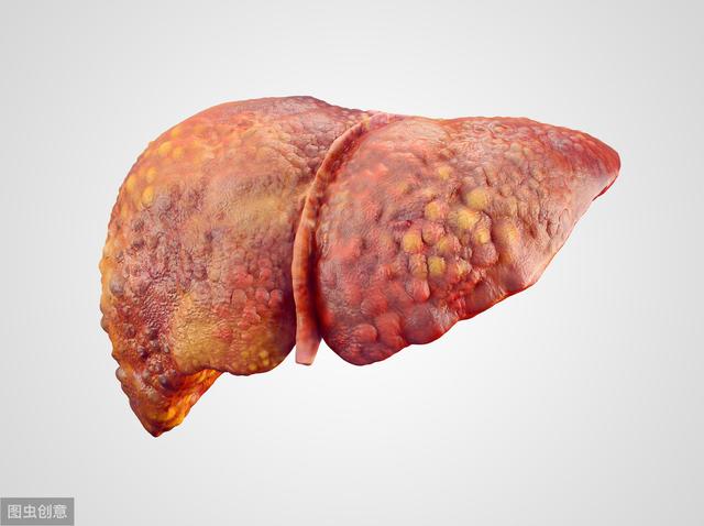 Từng người trong nhà lần lượt phát hiện ung thư gan, bác sĩ nhắc: 4 loại virus, vi khuẩn gây ung thư lây từ người sang người-1