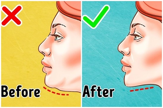 7 bài tập hiệu quả nhất để loại bỏ cằm đôi