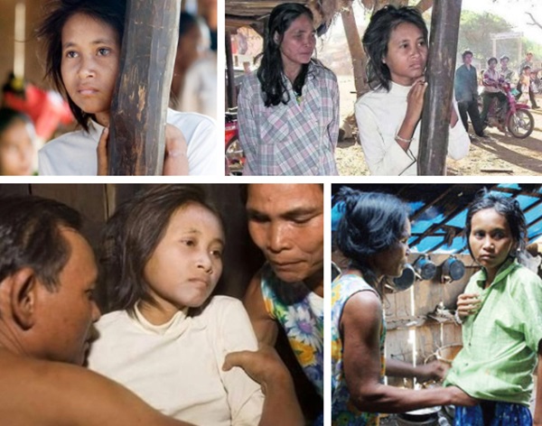 Mất tích từ năm 8 tuổi, cô gái thân tàn ma dại trở về sau 18 năm sống trong rừng đến nỗi mãi không thể hòa nhập với xã hội loài người-2