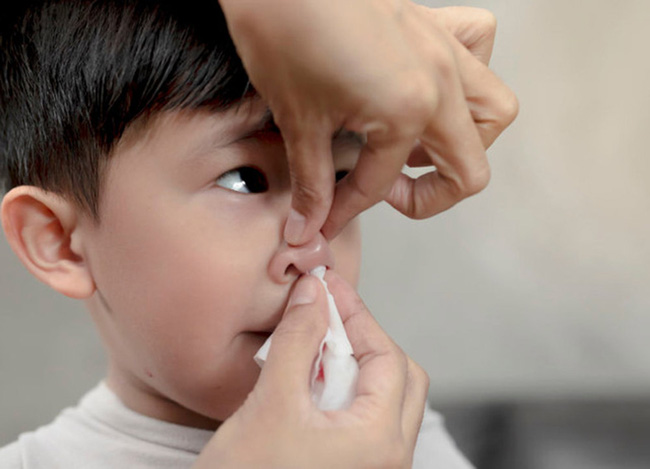 Cậu bé 2 tuổi chảy máu cam, người mẹ sai lầm trong cách sơ cứu khiến con trai tử vong ngay lập tức-2