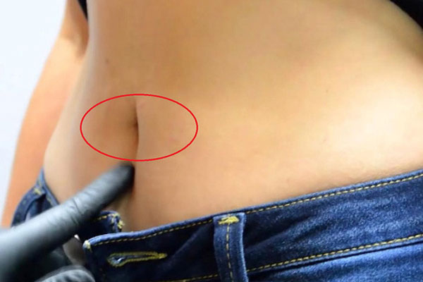 Bệnh ung thư khiến Ninh Dương Lan Ngọc suýt phải cắt buồng trứng, Hari Won chưa thể có con: Phụ nữ Việt mắc rất nhiều, dấu hiệu bệnh đơn giản nhưng dễ nhầm lẫn-10