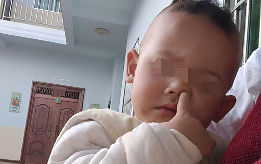 6 chi tiết ảnh hưởng lớn đến ngoại hình của trẻ nhưng hiếm khi cha mẹ nhận thấy, chẳng trách bé rất đẹp khi còn nhỏ nhưng lớn lên lại kém xinh-4