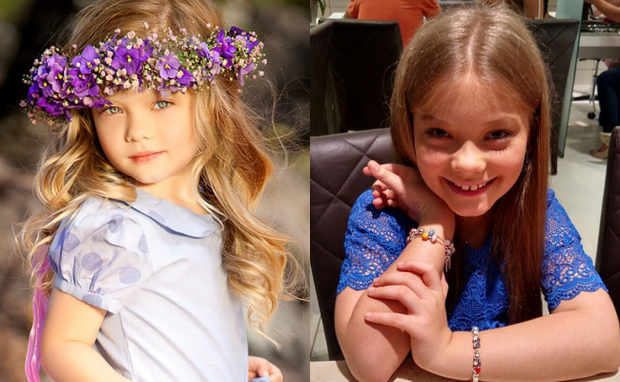 6 chi tiết ảnh hưởng lớn đến ngoại hình của trẻ nhưng hiếm khi cha mẹ nhận thấy, chẳng trách bé rất đẹp khi còn nhỏ nhưng lớn lên lại kém xinh-1