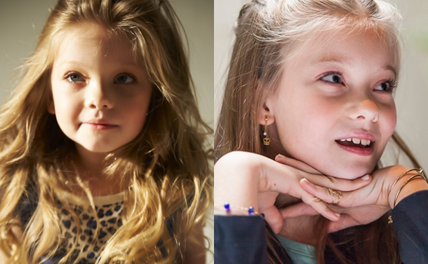 6 chi tiết ảnh hưởng lớn đến ngoại hình của trẻ nhưng hiếm khi cha mẹ nhận thấy, chẳng trách bé rất đẹp khi còn nhỏ nhưng lớn lên lại kém xinh-2