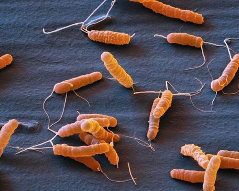 Ăn mực để trong tủ lạnh, cậu bé 11 tuổi rơi vào tình trạng nguy kịch và có thể phải chạy thận suốt đời-3