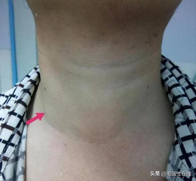 Ở những người thường xuyên tức giận, trên cơ thể xuất hiện 3 to 3 ít cảnh báo căn bệnh nguy hiểm-2