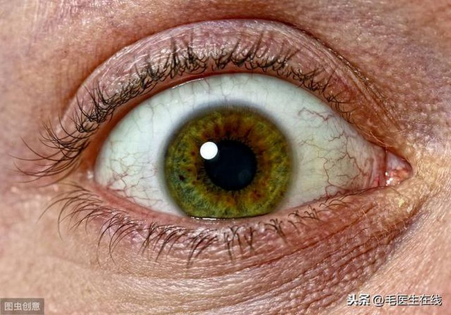 Ở những người thường xuyên tức giận, trên cơ thể xuất hiện 3 to 3 ít cảnh báo căn bệnh nguy hiểm-3