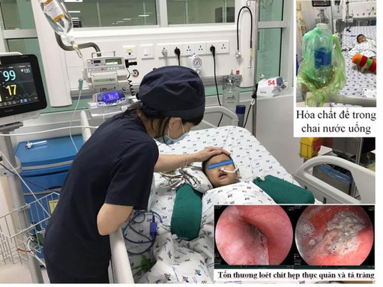 Bé 3 tuổi nguy kịch vì uống nhầm hóa chất-1