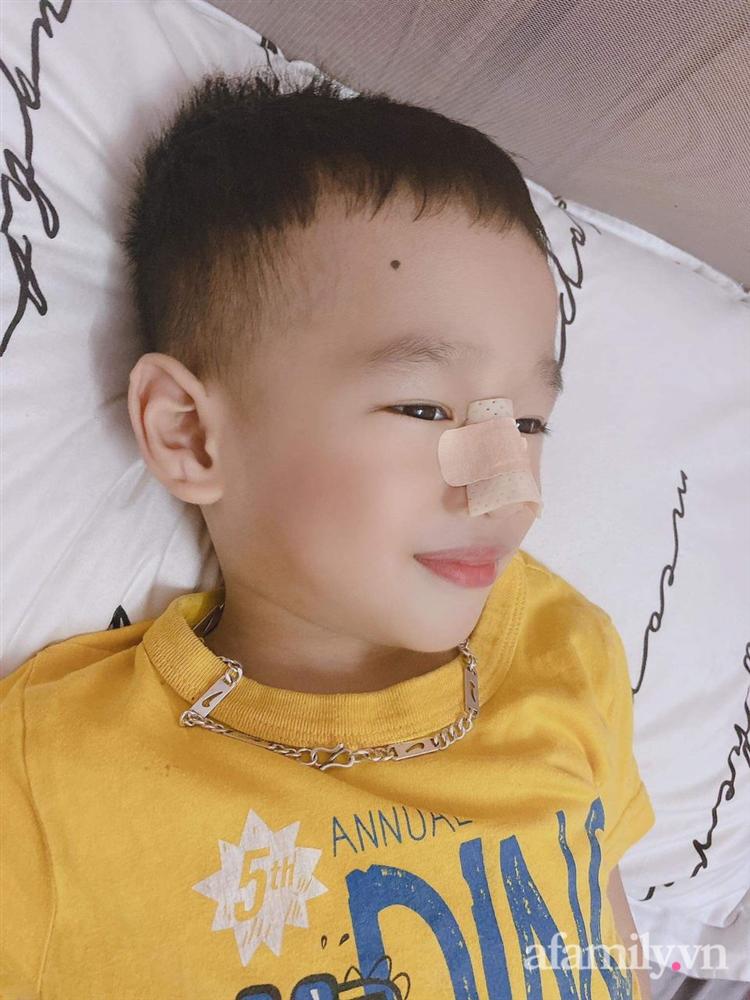 Thực hư hình ảnh bé trai 3 tuổi đã phẫu thuật nâng mũi kèm lời khẳng định của người mẹ: Xấu chỗ nào mẹ đập chỗ đó-1