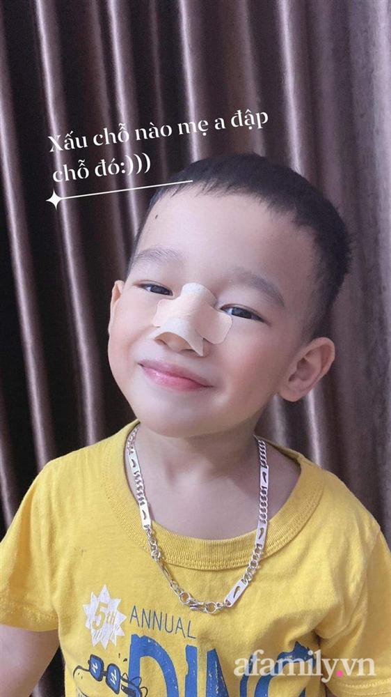 Thực hư hình ảnh bé trai 3 tuổi đã phẫu thuật nâng mũi kèm lời khẳng định của người mẹ: Xấu chỗ nào mẹ đập chỗ đó-3
