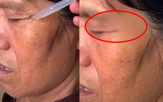 Thần dược xóa nhăn được quảng cáo rầm rộ trên Tiktok giúp da căng mịn trong vài giây, nhưng 1 chi tiết giả trân khiến dân mạng phì cười-2