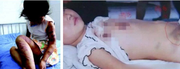 Vụ mẹ bạo hành con chấn động Trung Quốc: Cuộc đời ngắn ngủi đầy đòn roi của đứa trẻ kết thúc trong vai diễn hoàn hảo của mẹ-3