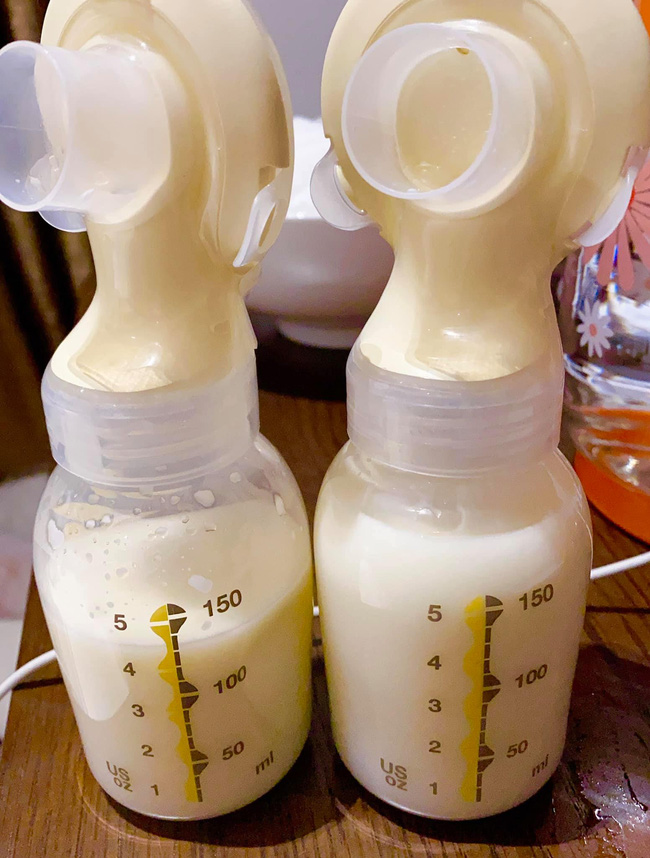 Từng nhiều sữa đến mức hút được 5 lít/ngày, nhưng con chưa tròn tháng Pha Lê đã phải cai sữa cho bé vì lý do đau đớn này-2