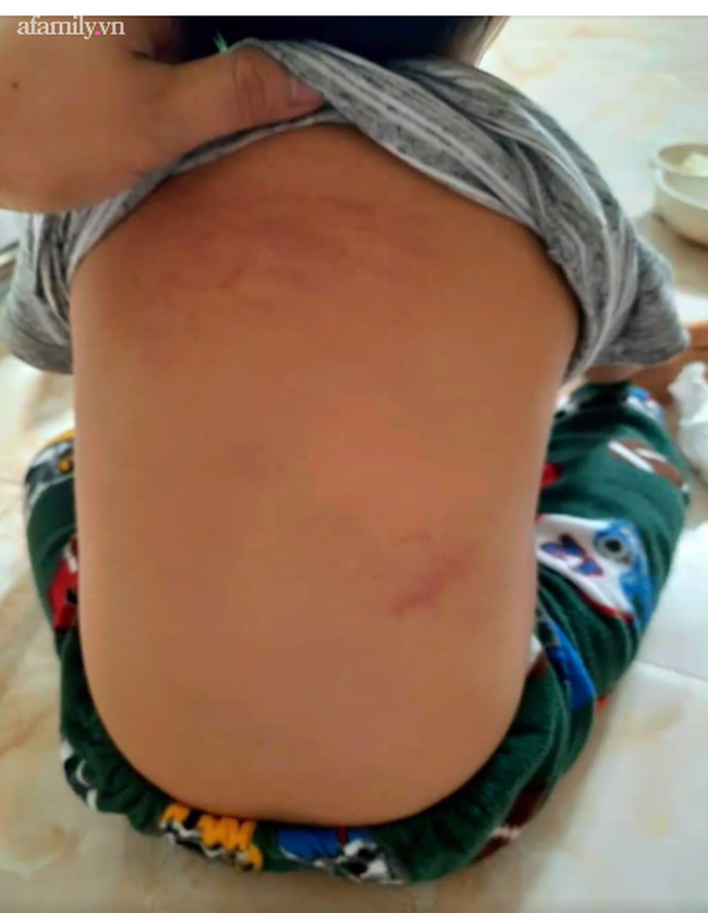 Vụ việc gây bức xúc: Cháu bé mầm non bị cô giáo bạo hành trong nhà vệ sinh, 1 cô khác thờ ơ đứng xem, dửng dưng như không có gì-1