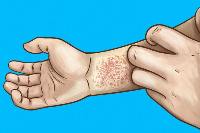 Những dấu hiệu cho thấy thận của bạn đang có vấn đề-3