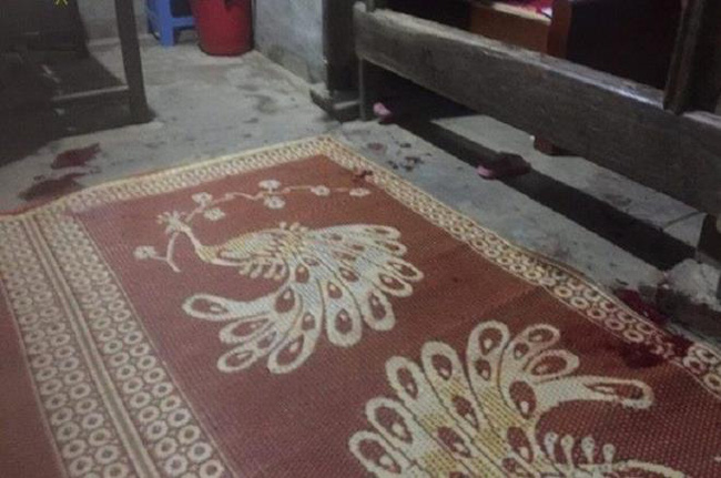 Mâu thuẫn trong bữa cơm tối, bố chồng đánh con dâu và 2 cháu nội nhập viện cấp cứu-1