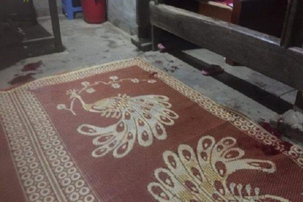 Vụ bố chồng đánh con dâu và 2 cháu nội nguy kịch: Con dâu đang mang thai, bé gái 4 tuổi vỡ sọ, tiên lượng xấu-2