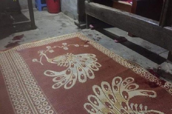 Mâu thuẫn trong bữa cơm tối, bố chồng đánh con dâu và 2 cháu nội nhập viện cấp cứu