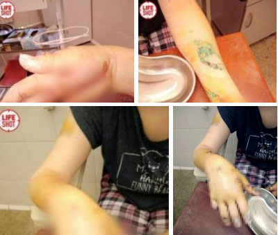 Ly hôn rồi đòi quay lại nhưng bị cự tuyệt thẳng thừng, gã đàn ông điên tiết dùng rìu tấn công vợ cũ để lại cảnh tượng ám ảnh-2