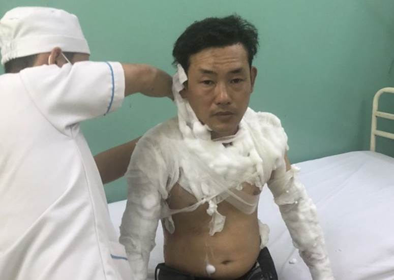 Kẻ tẩm xăng doạ đốt, cướp tiền chi nhánh ngân hàng TPBank ở Sài Gòn là ai?-1