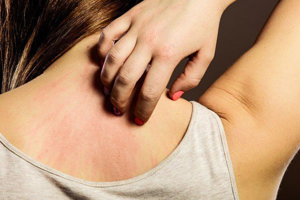 Món cá gây ung thư cao số 1 mà WHO cảnh báo hóa ra lại chính là món ngon hàng ngàn gia đình yêu thích-5