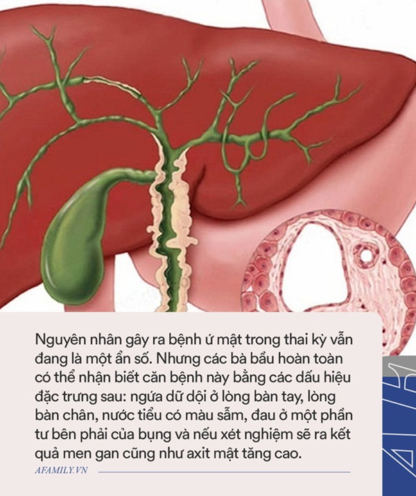 Càng về cuối thai kỳ càng bị ngứa, bà mẹ liền đi xét nghiệm, cầm kết quả trên tay bác sĩ đẩy ngay thai phụ vào phòng mổ khẩn cấp-3