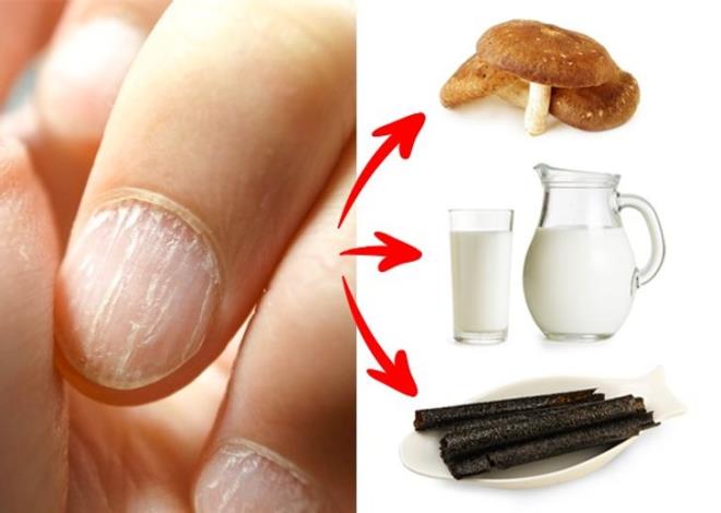 Những dấu hiệu chứng tỏ cơ thể bạn đang kêu cứu-6