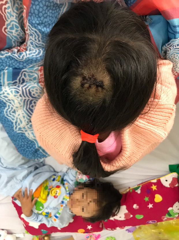 Vụ bố chồng dùng búa đánh con dâu và 2 cháu: Con dâu đang mang thai 5 tháng-2