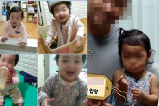 Được nhận nuôi chưa đầy 1 năm, bé gái bị bỏ bê và bạo hành đến mức thân tàn ma dại, ảnh trước và sau như 2 con người khác biệt