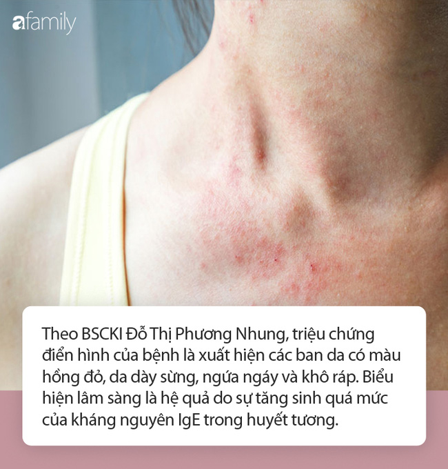 Bác sĩ da liễu cảnh báo bệnh về da rất dễ tái phát khi trời trở lạnh, dù trẻ hay già cũng đều khó tránh!-2