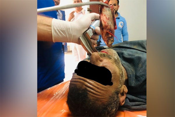 Cảnh lấy trứng cá hồi đạt gần 10 triệu lượt xem-1