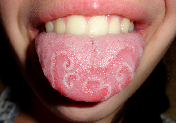 Bất luận nam hay nữ nếu miệng có 3 điểm bất thường chứng tỏ dạ dày đã tổn thương, khám ngay trước khi ung thư đến-3