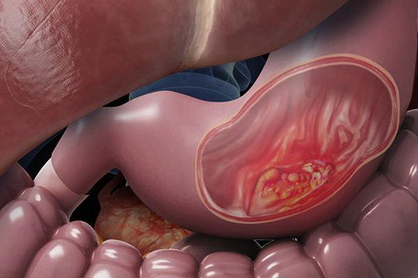 5 thói quen xấu của dân văn phòng tiềm ẩn nguy cơ mắc bệnh nguy hiểm-2