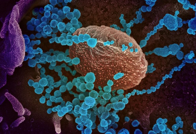 Phát hiện virus lây từ người sang người, gây chết chóc tại Bolivia: Dấy lên lo ngại bùng phát dịch bệnh mới!-1