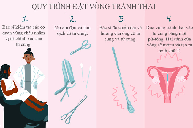 Tận mắt chứng kiến quy trình đặt vòng tránh thai mới thấy quá thương các mẹ-2