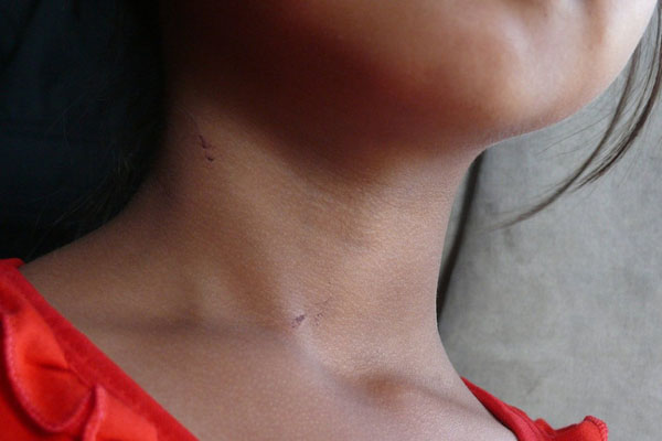 Vị bác sĩ da liễu bị tố hiếp dâm nữ điều dưỡng khai gì trước tòa?-2