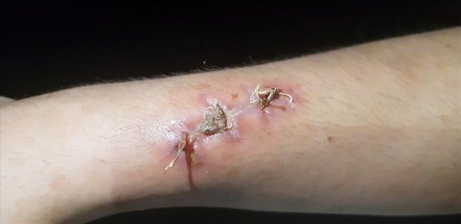 Nữ chủ quán bánh xèo ở Bắc Ninh bị tố tra tấn dã man nhân viên, trong đó có bé trai 15 tuổi khai gì với công an?-1