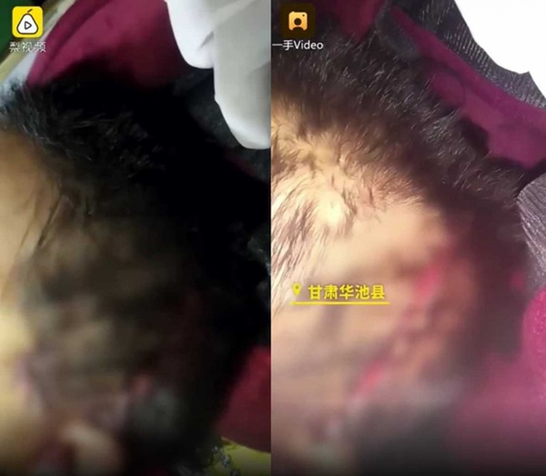 Mới cưới được 2 tháng, chồng bắn chết vợ bằng súng bắn đinh, mâu thuẫn giữa cảnh sát và gia đình gây hoang mang-2