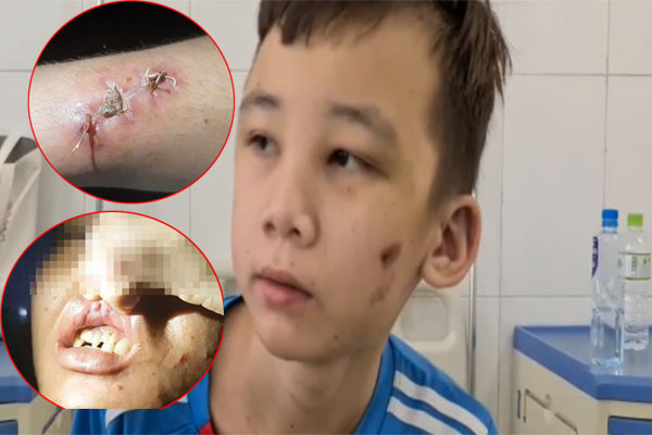 Video: Công an Bắc Ninh lên tiếng vụ bé trai 14 tuổi bị chủ quán tra tấn dã man-1