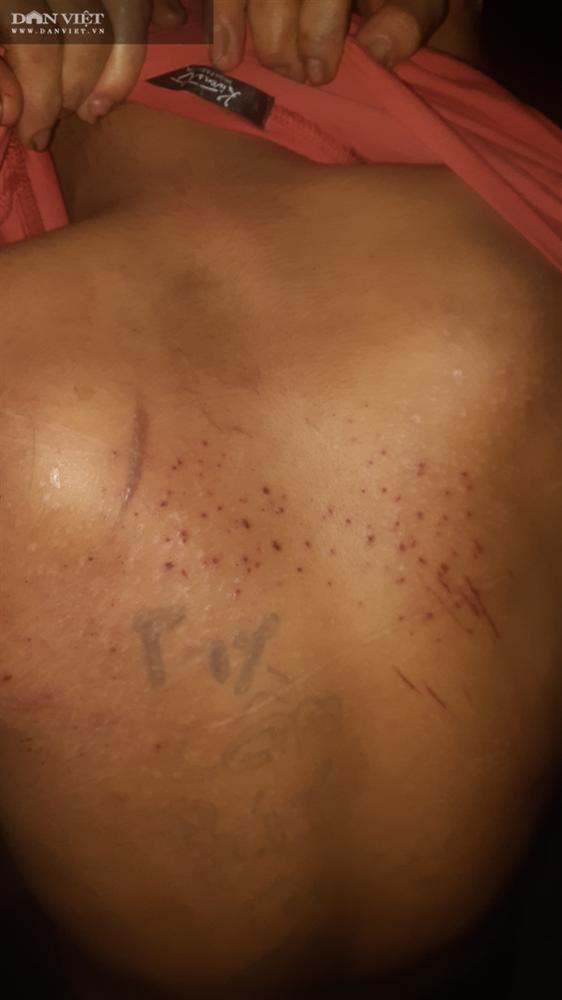 Anh trai nhân viên 15 tuổi nghi bị chủ quán bánh xèo bạo hành dã man ở Bắc Ninh: Tôi rất xót xa!-3