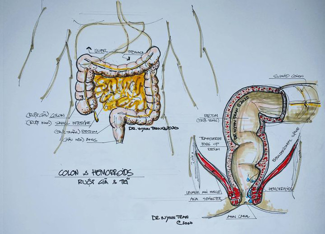 Tự ý bơm thụt cà phê để... detox cơ thể: Chuyên gia khẳng định nguy hiểm và không có bằng chứng khoa học!-3