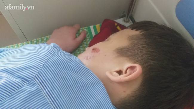 Kinh hoàng lời kể nạn nhân 15 tuổi bị chủ quán bánh xèo tra tấn: Bị đánh đập nhiều lần bằng chày đập đá và cạo vảy cá khiến cơ thể thương tích nặng nề, tinh thần hoảng loạn-1