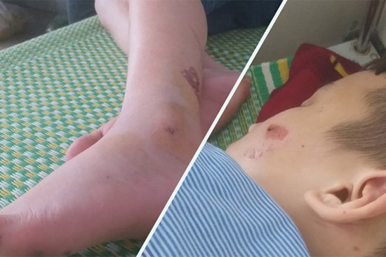 Kinh hoàng lời kể nạn nhân 15 tuổi bị chủ quán bánh xèo 