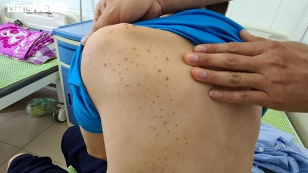 Chân dung chủ quán bánh xèo Bắc Ninh tra tấn cậu bé dã man như thời trung cổ-3