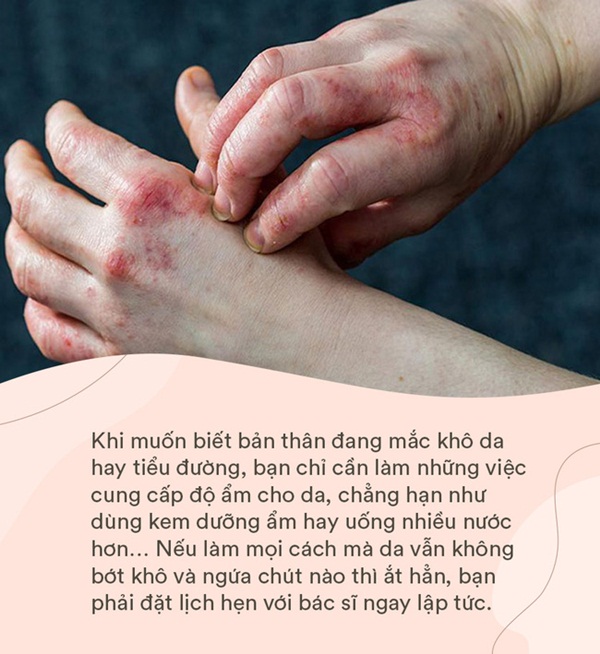 Bệnh tiểu đường đang âm thầm phát triển nếu bạn có một trong 6 dấu hiệu này trên da: Đa phần hệt như viêm da khiến nhiều người chủ quan-3